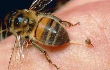 养蜂人会得风湿病吗(养蜂的人不会得癌症吗)