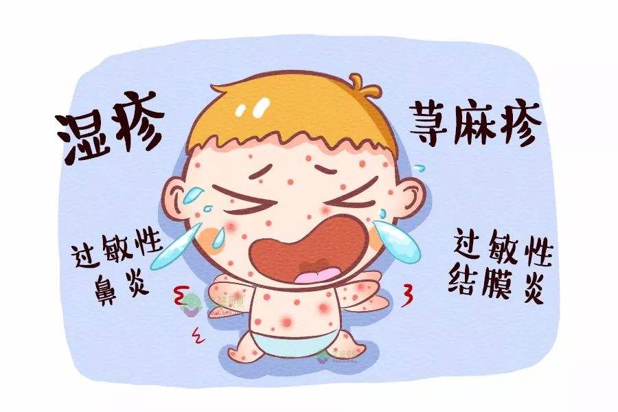 过敏有什么症状表现（判断是否过敏的方法）