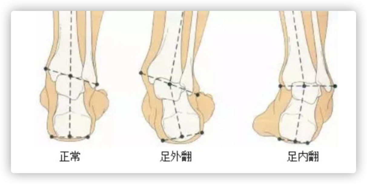 选鞋不求人——这篇文章告诉你跑鞋到底怎么选